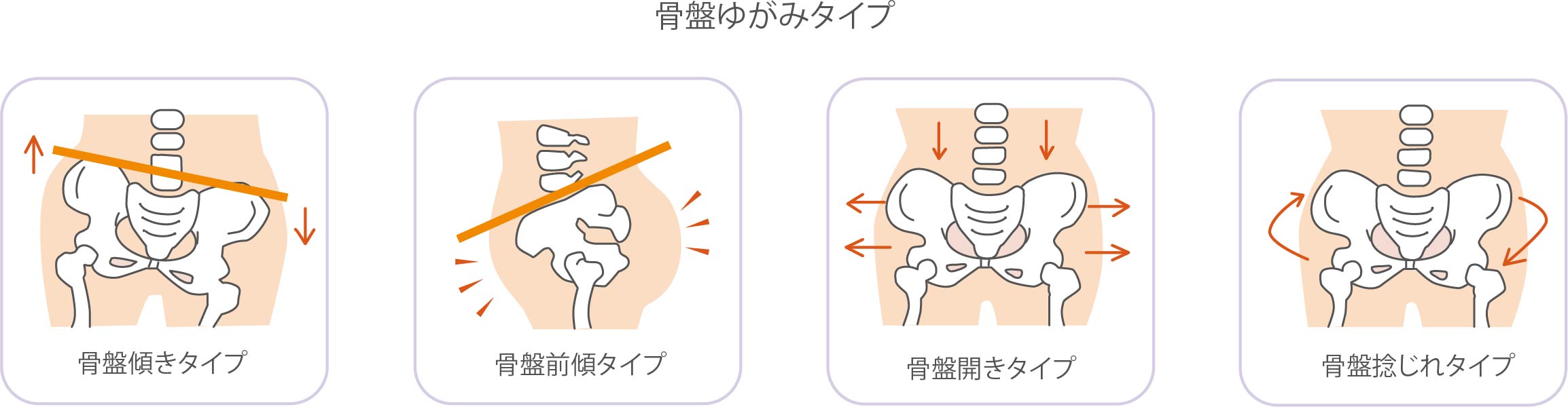 身体が歪むと様々な不調が起こる!?